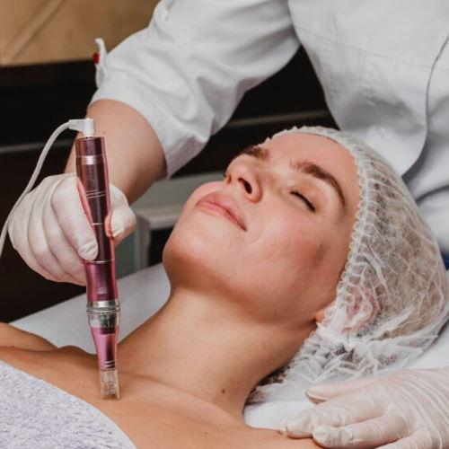 MICRO NEEDLING DEKOLLETE