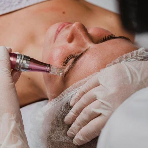 AUGEN MICRONEEDLING