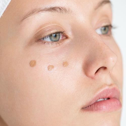 MICRONEEDLING MIT BB GLOW