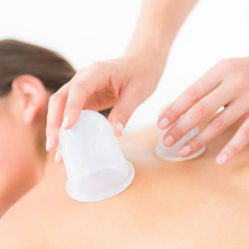 Schröpfen und Schröpfmassage 